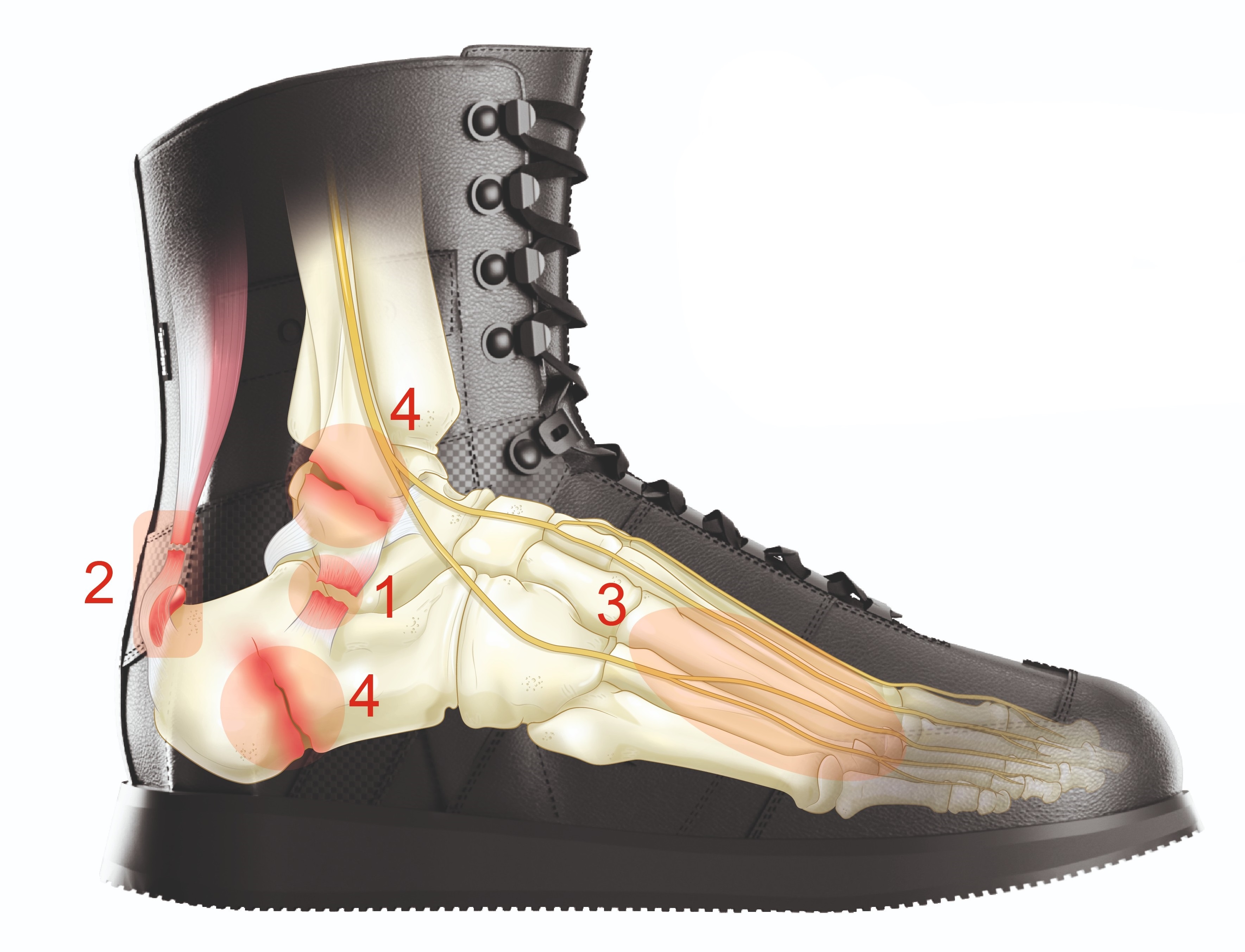Illustration Indikationen